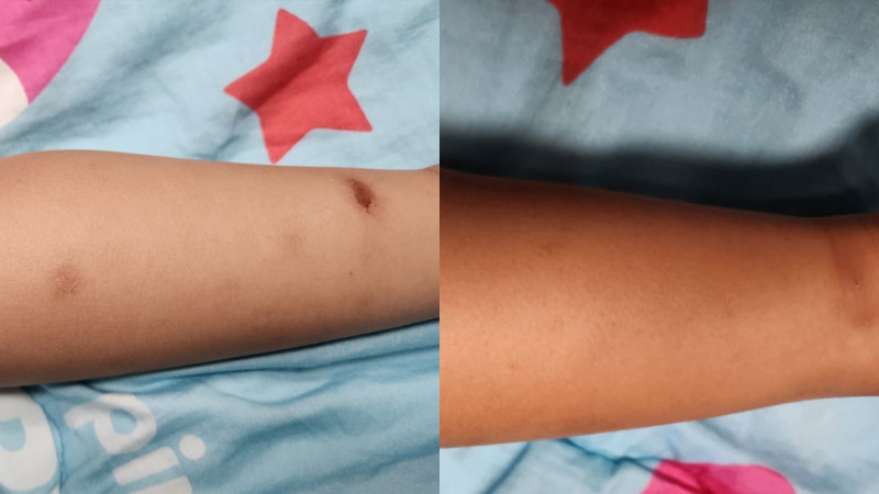 아토5분 유성 아토피 놀란바이오 제품 아이 관리 후기